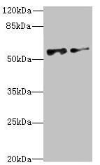 NEK3 Antibody - Western blot All lanes: NEK3 antibody at 6.04µg/ml Lane 1: MCF-7 whole cell lysate Lane 2: Hela whole cell lysate Secondary Goat polyclonal to rabbit IgG at 1/10000 dilution Predicted band size: 58, 56 kDa Observed band size: 58 kDa