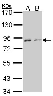 NEK4 Antibody - Sample (30 ug of whole cell lysate). A: A431 , B: H1299. 7.5% SDS PAGE. NEK4 antibody diluted at 1:1000.
