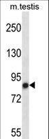 NEK4 Antibody - Mouse Nek4 Antibody western blot of mouse testis tissue lysates (35 ug/lane). The Nek4 antibody detected the Nek4 protein (arrow).