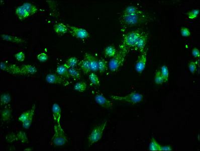 NEK4 Antibody - Immunofluorescence staining of Hela cells at a dilution of 1:100, counter-stained with DAPI. The cells were fixed in 4% formaldehyde, permeabilized using 0.2% Triton X-100 and blocked in 10% normal Goat Serum. The cells were then incubated with the antibody overnight at 4 °C.The secondary antibody was Alexa Fluor 488-congugated AffiniPure Goat Anti-Rabbit IgG (H+L) .