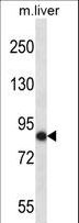 NEK5 Antibody - Mouse Nek5 Antibody western blot of mouse liver tissue lysates (35 ug/lane). The Nek5 antibody detected the Nek5 protein (arrow).