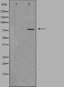 NEK5 Antibody - Western blot analysis of extracts of HepG2 cells using NEK5 antibody. The lane on the left is treated with the antigen-specific peptide.