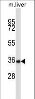 NEK6 Antibody - Mouse Nek6 Antibody western blot of mouse liver tissue lysates (35 ug/lane). The Nek6 antibody detected the Nek6 protein (arrow).