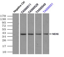 NEK6 Antibody - Immunoprecipitation(IP) of NEK6 by using monoclonal anti-NEK6 antibodies (Negative control: IP without adding anti-NEK6 antibody.). For each experiment, 500ul of DDK tagged NEK6 overexpression lysates (at 1:5 dilution with HEK293T lysate), 2 ug of anti-NEK6 antibody and 20ul (0.1 mg) of goat anti-mouse conjugated magnetic beads were mixed and incubated overnight. After extensive wash to remove any non-specific binding, the immuno-precipitated products were analyzed with rabbit anti-DDK polyclonal antibody.