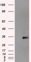 NEK6 Antibody - HEK293T cells were transfected with the pCMV6-ENTRY control (Left lane) or pCMV6-ENTRY NEK6 (Right lane) cDNA for 48 hrs and lysed. Equivalent amounts of cell lysates (5 ug per lane) were separated by SDS-PAGE and immunoblotted with anti-NEK6.