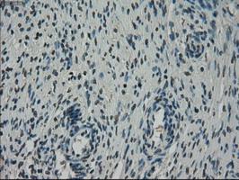 NEK6 Antibody - IHC of paraffin-embedded Ovary tissue using anti-NEK6 mouse monoclonal antibody. (Dilution 1:50).