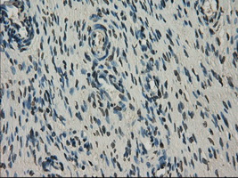 NEK6 Antibody - Immunohistochemical staining of paraffin-embedded Ovary tissue using anti-NEK6 mouse monoclonal antibody. (Dilution 1:50).
