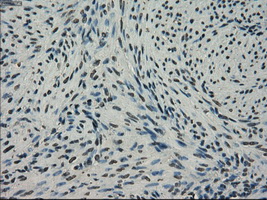 NEK6 Antibody - Immunohistochemical staining of paraffin-embedded endometrium tissue using anti-NEK6 mouse monoclonal antibody. (Dilution 1:50).