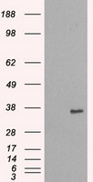 NEK6 Antibody - HEK293T cells were transfected with the pCMV6-ENTRY control (Left lane) or pCMV6-ENTRY NEK6 (Right lane) cDNA for 48 hrs and lysed. Equivalent amounts of cell lysates (5 ug per lane) were separated by SDS-PAGE and immunoblotted with anti-NEK6.