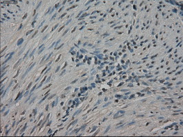 NEK6 Antibody - IHC of paraffin-embedded endometrium tissue using anti-NEK6 mouse monoclonal antibody. (Dilution 1:50).