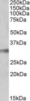 NEK7 Antibody - NEK7 antibody (0.1 ug/ml) staining of Human Lung lysate (35 ug protein/ml in RIPA buffer). Primary incubation was 1 hour. Detected by chemiluminescence.
