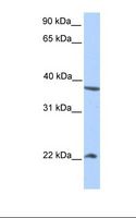 NEK7 Antibody - HepG2 cell lysate. Antibody concentration: 1.0 ug/ml. Gel concentration: 12%.  This image was taken for the unconjugated form of this product. Other forms have not been tested.