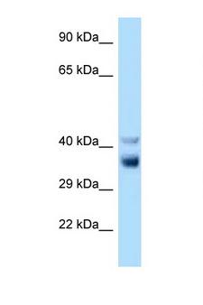 NEK7 Antibody - NEK7 antibody Western blot of Rat Liver lysate. Antibody concentration 1 ug/ml.  This image was taken for the unconjugated form of this product. Other forms have not been tested.