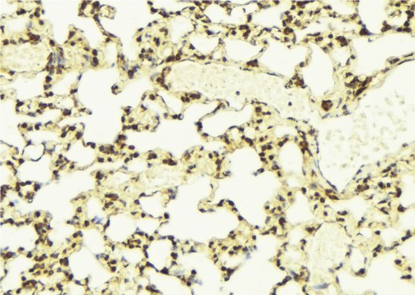NEK7 Antibody - 1:100 staining mouse lung tissue by IHC-P. The sample was formaldehyde fixed and a heat mediated antigen retrieval step in citrate buffer was performed. The sample was then blocked and incubated with the antibody for 1.5 hours at 22°C. An HRP conjugated goat anti-rabbit antibody was used as the secondary.