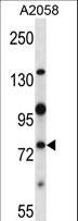 NEK8 Antibody - Mouse Nek8 Antibody western blot of A2058 cell line lysates (35 ug/lane). The Nek8 antibody detected the Nek8 protein (arrow).