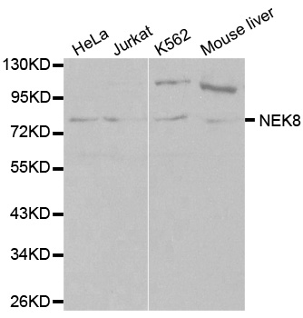 NEK8 Antibody - Western blot analysis of extracts of various cell lines, using NEK8 antibody at 1:1000 dilution. The secondary antibody used was an HRP Goat Anti-Rabbit IgG (H+L) at 1:10000 dilution. Lysates were loaded 25ug per lane and 3% nonfat dry milk in TBST was used for blocking.