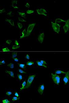 NEK8 Antibody - Immunofluorescence analysis of HeLa cells using NEK8 antibody. Blue: DAPI for nuclear staining.