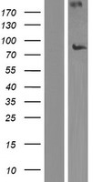 NEK8 Protein - Western validation with an anti-DDK antibody * L: Control HEK293 lysate R: Over-expression lysate