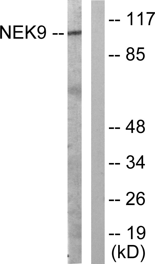 NEK9 Antibody - Western blot analysis of lysates from A549 cells, using NEK9 Antibody. The lane on the right is blocked with the synthesized peptide.