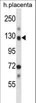 NEK9 Antibody - Mouse Nek9 Antibody western blot of human placenta tissue lysates (35 ug/lane). The Nek9 antibody detected the Nek9 protein (arrow).