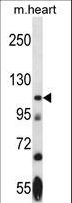 NEK9 Antibody - Mouse Nek9 Antibody western blot of mouse heart tissue lysates (35 ug/lane). The Nek9 antibody detected the Nek9 protein (arrow).