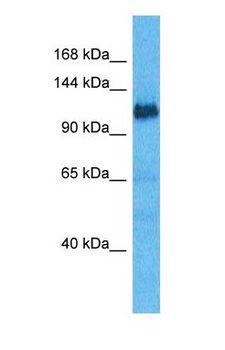 NEK9 Antibody - Western blot of NEK9 Antibody with human Jurkat Whole Cell lysate.  This image was taken for the unconjugated form of this product. Other forms have not been tested.