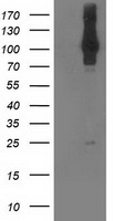 NEK9 Antibody - HEK293T cells were transfected with the pCMV6-ENTRY control (Left lane) or pCMV6-ENTRY NEK9 (Right lane) cDNA for 48 hrs and lysed. Equivalent amounts of cell lysates (5 ug per lane) were separated by SDS-PAGE and immunoblotted with anti-NEK9.