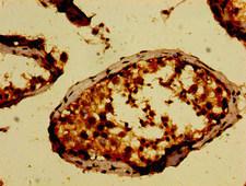 NEK9 Antibody - Immunohistochemistry image of paraffin-embedded human testis tissue at a dilution of 1:100