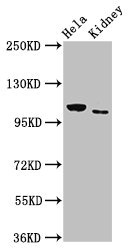 NEK9 Antibody - Positive Western Blot detected in Hela whole cell lysate, Rat kidney tissue. All lanes: NEK9 antibody at 3 µg/ml Secondary Goat polyclonal to rabbit IgG at 1/50000 dilution. Predicted band size: 132, 54, 57, 118, 25, 97 KDa. Observed band size: 132 KDa