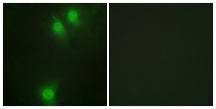 NEK9 Antibody - Immunofluorescence analysis of HeLa cells, using NEK9 (Phospho-Thr210) Antibody. The picture on the right is blocked with the phospho peptide.
