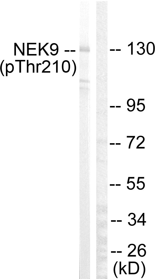 NEK9 Antibody - Western blot analysis of lysates from HepG2 cells, using NEK9 (Phospho-Thr210) Antibody. The lane on the right is blocked with the phospho peptide.