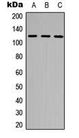NEK9 Antibody - Western blot analysis of NEK9 (pT210) expression in THP1 (A); HepG2 (B); HeLa (C) whole cell lysates.