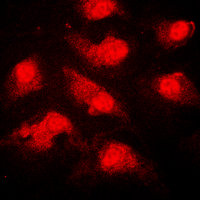 NEK9 Antibody - Immunofluorescent analysis of NEK9 (pT210) staining in THP1 cells. Formalin-fixed cells were permeabilized with 0.1% Triton X-100 in TBS for 5-10 minutes and blocked with 3% BSA-PBS for 30 minutes at room temperature. Cells were probed with the primary antibody in 3% BSA-PBS and incubated overnight at 4 deg C in a humidified chamber. Cells were washed with PBST and incubated with a DyLight 594-conjugated secondary antibody (red) in PBS at room temperature in the dark. DAPI was used to stain the cell nuclei (blue).