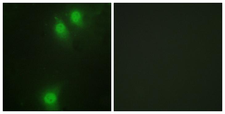 NEK9 Antibody - P-peptide - + Immunofluorescence analysis of HeLa cells, using NEK9 (Phospho-Thr210) antibody.
