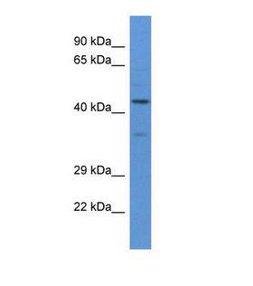 NELFA / WHSC2 Antibody - Western blot of Human PANC1. WHSC2 antibody dilution 1.0 ug/ml.  This image was taken for the unconjugated form of this product. Other forms have not been tested.