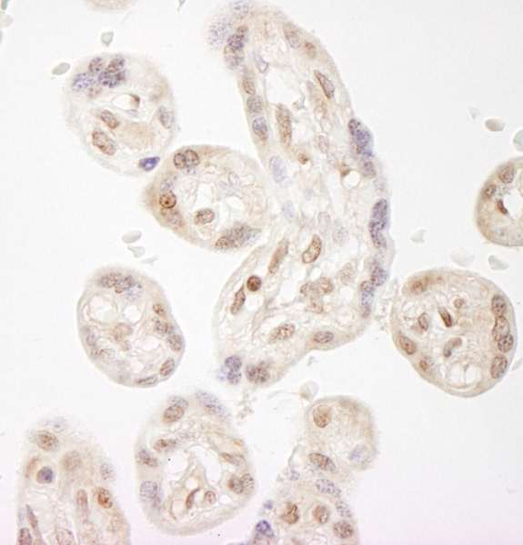 NELFA / WHSC2 Antibody - Detection of Human NELFA by Immunohistochemistry. Sample: FFPE section of human placenta. Antibody: Affinity purified rabbit anti-NELFA used at a dilution of 1:250.