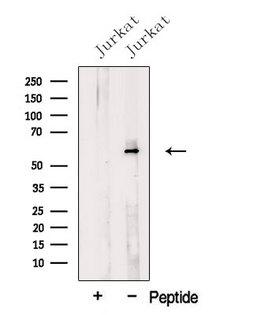 NELFA / WHSC2 Antibody - Western blot analysis of extracts of 293 cells using NELF-A antibody. The lane on the left was treated with blocking peptide.
