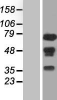 NELFA / WHSC2 Protein - Western validation with an anti-DDK antibody * L: Control HEK293 lysate R: Over-expression lysate