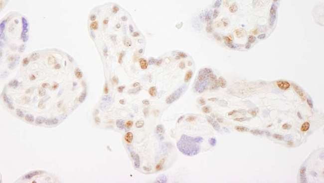NELFB / COBRA1 Antibody - Detection of Human COBRA1 by Immunohistochemistry. Sample: FFPE section of human placenta. Antibody: Affinity purified rabbit anti-COBRA1 used at a dilution of 1:200 (1 ug/ml).