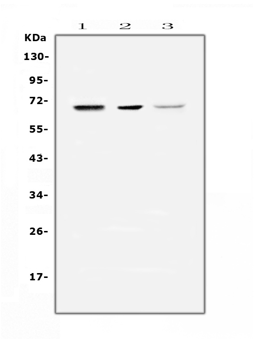 NELFB / COBRA1 Antibody - Western blot analysis of COBRA1 using anti-COBRA1 antibody. Electrophoresis was performed on a 5-20% SDS-PAGE gel at 70V (Stacking gel) / 90V (Resolving gel) for 2-3 hours. The sample well of each lane was loaded with 50ug of sample under reducing conditions. Lane 1: rat kidney tissue lysates, Lane 2: mouse kidney tissue lysates, Lane 3: human MDA-MB-231 whole cell lysates. After Electrophoresis, proteins were transferred to a Nitrocellulose membrane at 150mA for 50-90 minutes. Blocked the membrane with 5% Non-fat Milk/ TBS for 1.5 hour at RT. The membrane was incubated with rabbit anti-COBRA1 antigen affinity purified polyclonal antibody at 0.5 ?g/mL overnight at 4?C, then washed with TBS-0.1% Tween 3 times with 5 minutes each and probed with a goat anti-rabbit IgG-HRP secondary antibody at a dilution of 1:10000 for 1.5 hour at RT. The signal is developed using an Enhanced Chemiluminescent detection (ECL) kit with Tanon 5200 system. A specific band was detected for COBRA1 at approximately 66KD. The expected band size for COBRA1 is at 66KD.