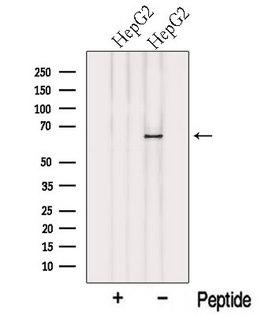 NELFB / COBRA1 Antibody - Western blot analysis of extracts of HepG2 cells using NELFB antibody. The lane on the left was treated with blocking peptide.