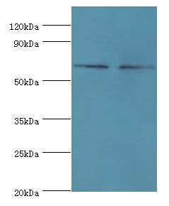 NELFCD / TH1L / TH1 Antibody - Western blot. All lanes: NELFCD antibody at 8 ug/ml. Lane 1: Jurkat whole cell lysate. Lane 2: HeLa whole cell lysate. Secondary antibody: Goat polyclonal to rabbit at 1:10000 dilution. Predicted band size: 66 kDa. Observed band size: 66 kDa.