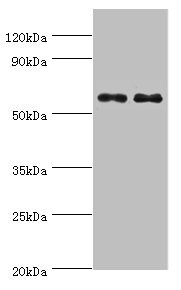 NELFCD / TH1L / TH1 Antibody - Western blot All lanes: NELFCD antibody at 8µg/ml Lane 1: Jurkat whole cell lysate Lane 2: Hela whole cell lysate Secondary Goat polyclonal to rabbit IgG at 1/10000 dilution Predicted band size: 67, 23, 66 kDa Observed band size: 67 kDa