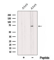 NELFCD / TH1L / TH1 Antibody - Western blot analysis of extracts of A549 cells using TH1L antibody. The lane on the left was treated with blocking peptide.