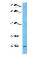 NELFCD / TH1L / TH1 Antibody - Western blot of NELFD Antibody with human MCF7 Whole Cell lysate.  This image was taken for the unconjugated form of this product. Other forms have not been tested.