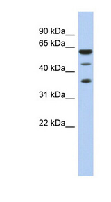 NELFE / RD / RDBP Antibody - RDBP antibody Western blot of Fetal Spleen lysate. This image was taken for the unconjugated form of this product. Other forms have not been tested.