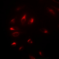 NELFE / RD / RDBP Antibody - Immunofluorescent analysis of NELF-E staining in U2OS cells. Formalin-fixed cells were permeabilized with 0.1% Triton X-100 in TBS for 5-10 minutes and blocked with 3% BSA-PBS for 30 minutes at room temperature. Cells were probed with the primary antibody in 3% BSA-PBS and incubated overnight at 4 deg C in a humidified chamber. Cells were washed with PBST and incubated with a DyLight 594-conjugated secondary antibody (red) in PBS at room temperature in the dark.
