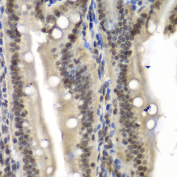 NELFE / RD / RDBP Antibody - Immunohistochemistry of paraffin-embedded mouse Intestine using NELFE antibody at dilution of 1:100 (40x lens).