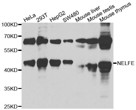 NELFE / RD / RDBP Antibody - Western blot analysis of extracts of various cell lines, using NELFE antibody at 1:1000 dilution. The secondary antibody used was an HRP Goat Anti-Rabbit IgG (H+L) at 1:10000 dilution. Lysates were loaded 25ug per lane and 3% nonfat dry milk in TBST was used for blocking. An ECL Kit was used for detection and the exposure time was 90s.