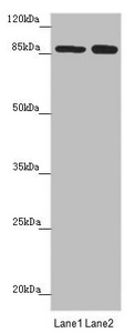 NELL1 Antibody - Western blot All Lanes: NELL1 antibody at 4.52 ug/ml Lane 1: Hela whole cell lysate Lane 2: Jurkat whole cell lysate Secondary Goat polyclonal to rabbit IgG at 1/10000 dilution Predicted band size: 90,85 kDa Observed band size: 90 kDa